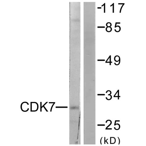 anti cdk7 antikörper a98222