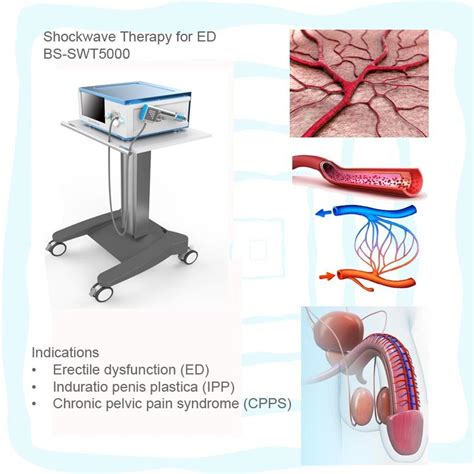 China Gainswave Eswt Low Intensity Shockwave Therapy For Erectile
