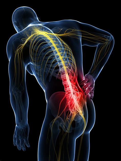 sciatic nerve    pain  overview results rehabilitation
