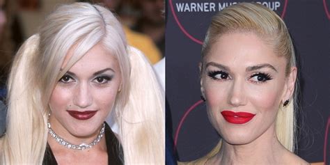 gwen stefani s plastic surgery rumors face before and after
