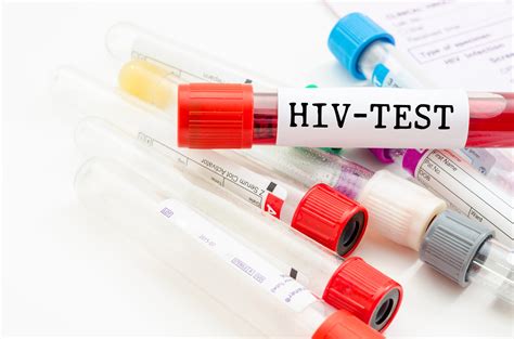 young people  access  hiv tests financial tribune