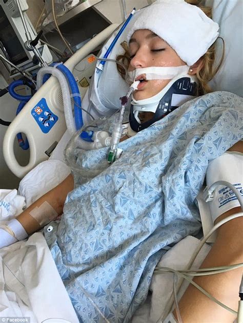 massachusetts mother posts horrifying pics of teen daughter in coma after alcohol overdose