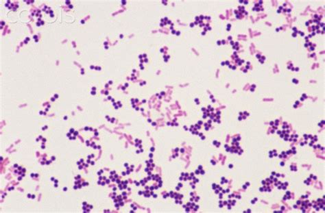 5 Steps Of Gram Staining Procedure How To Interpret The Results New