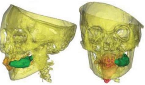 incan children mummies drugged  beer  cocaine  left  freeze  death daily mail