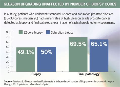 saturation prostate biopsy not better renal and urology news