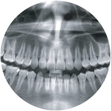 orthodontist  minden sateline nv paragini orthodontics
