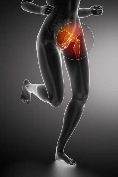 Physical Therapist S Guide To Groin Strain
