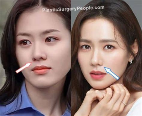 son ye jin before and after