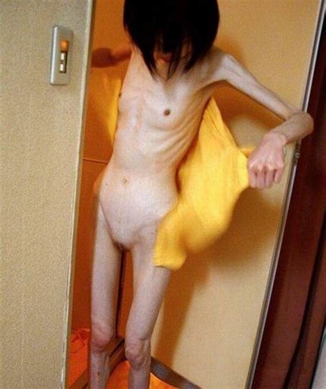anorexic porn thread nws page 14 yellow bullet forums