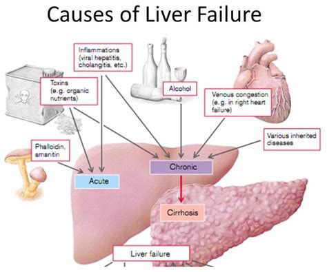 acute liver failure  signs symptoms diagnosis  treatment