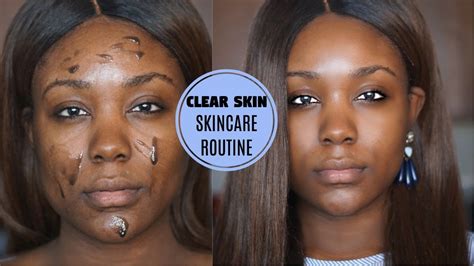 oily skin acne skin care routine dark spots pores to