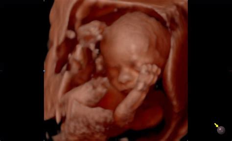 image gallery  bellies ultrasound ddd dhd pregnancy spa