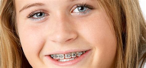 how soon should your pre teen see the orthodontist