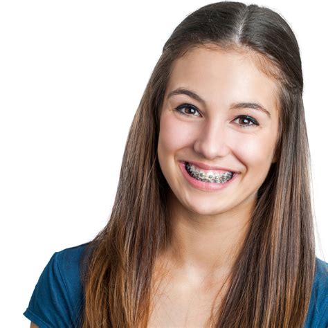 Young Girls With Braces On Teeth – Telegraph