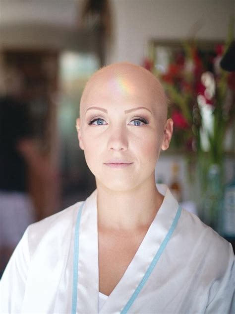 this bride with alopecia embraced her baldness on her wedding day allure
