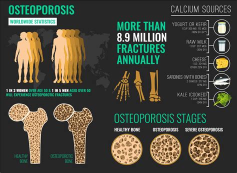 osteoporosis a misunderstood condition