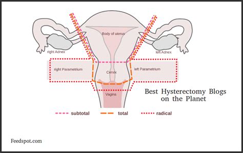 top 5 hysterectomy blogs and websites to follow in 2021