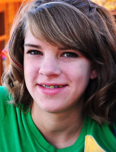 teen girl smile braces carissa rogers flickr