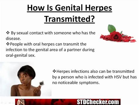 genital herpes important info symptoms and treatment