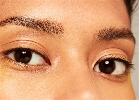 reasons younger patients   eyelid surgery realself news