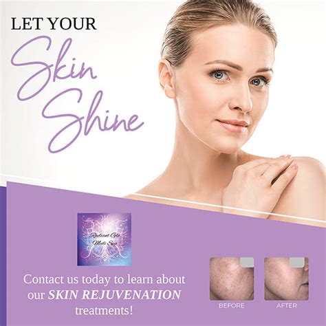 medically safe skin rejuvenation radiant glo medi spa