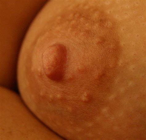 Close Up Pics Of Nipples Xnxx Adult Forum