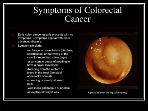 blood  stool colon cancer symptoms images