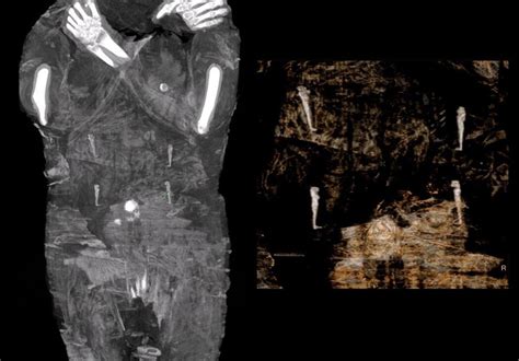 first known pregnant mummy discovered live science