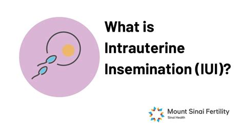 Intrauterine Insemination Youtube