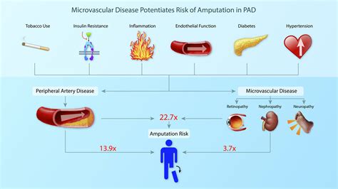 Microvascular Disease Increases Amputation In Patients