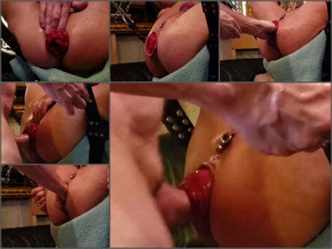 amateur amazing gays porn fisted and fuck huge anal prolapse rare amateur fetish video
