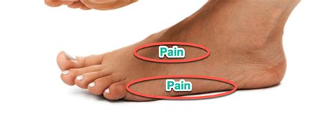 What Is Causing My Severe Pain On The Outside Of My Foot Bones