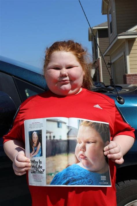 obese girl gets lifesaving surgery [video]