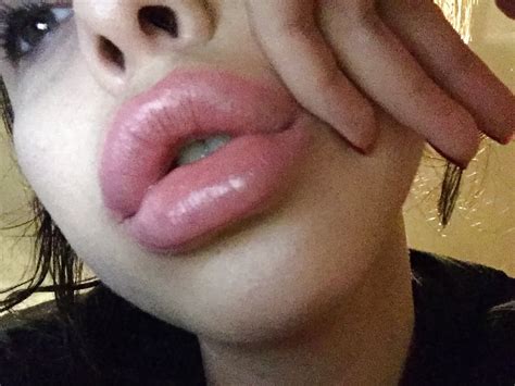 thick fake plastic bimbo lips 64 pics xhamster
