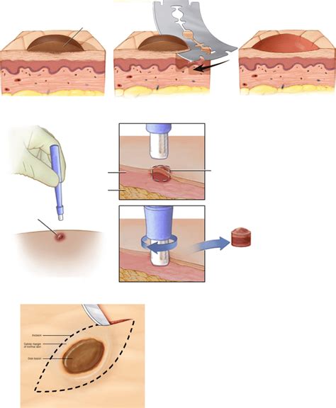 skin biopsy   current standard  skin conditions diagnosis