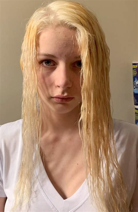 Hair Bleaching Chemicals In 4 Product Cause Teen’s Hair To Melt Fall
