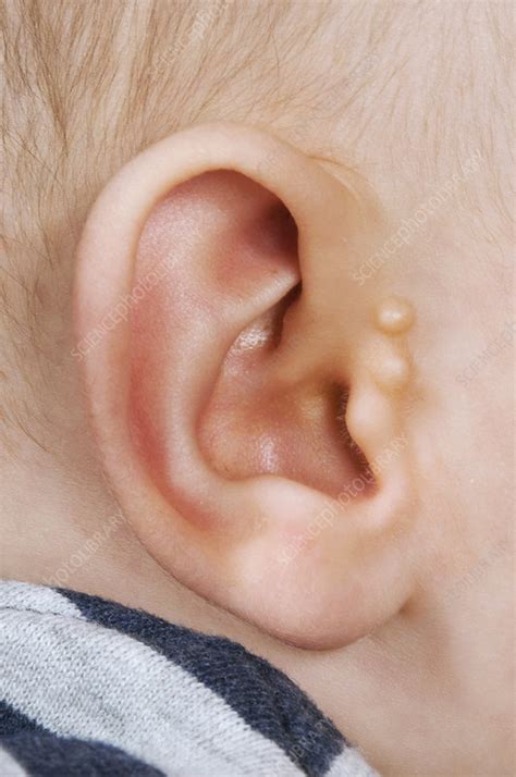 accessory auricle stock image  science photo library