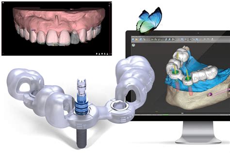 digital dentistry concept bangkok dental hospital