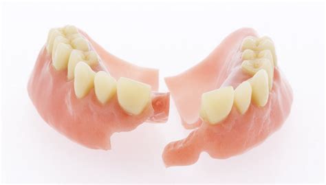 reparatie van uw kunstgebit tandprothetische praktijk reijshoeve