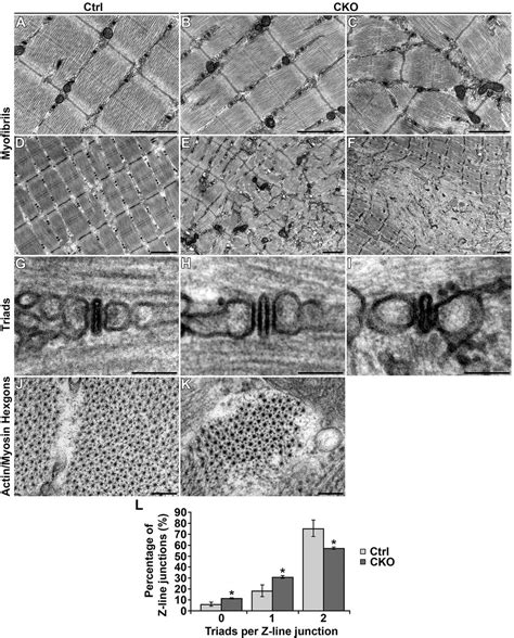 Mouse Myofibers Lacking The Smyd1 Methyltransferase Are