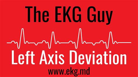 left axis deviation  ekg ecg   ekg guy wwwekgmd youtube