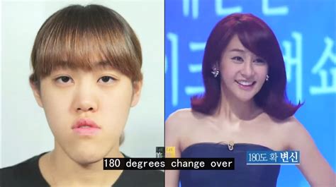 This South Korean Plastic Surgery Makeover Show Is The