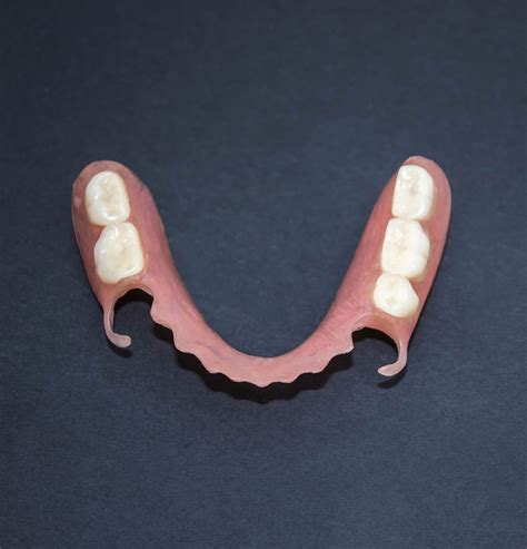 partial dentures   tooth replacement dentist