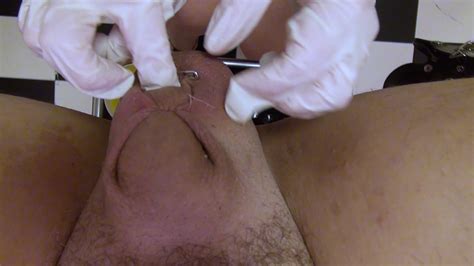 Super Nurse Cbt Sewing Needle Fisting Straight Video