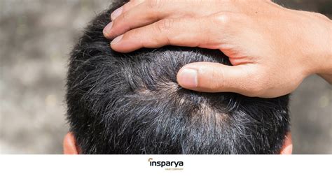itchy  painful irritated scalp solutions insparya hair clinic