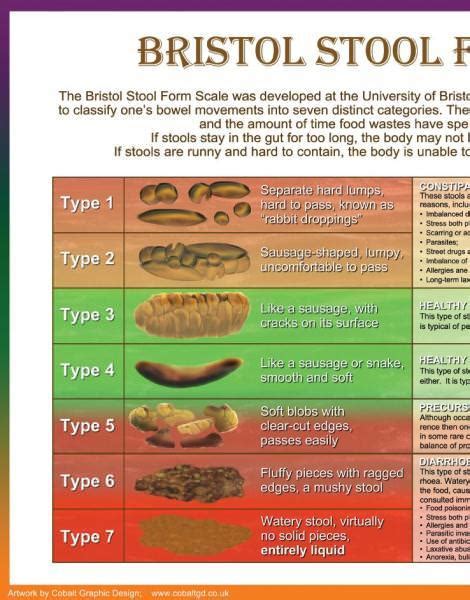 unique visual tool bristol stool scale poster serves   educational aid