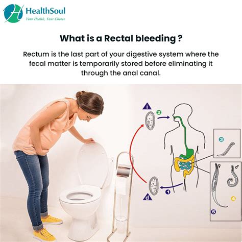rectal bleeding causes and treatment healthsoul