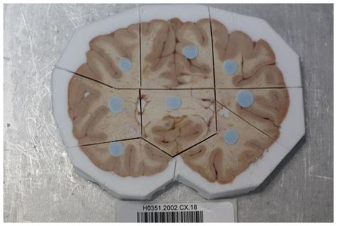 atlas   solve mysteries   human brain science