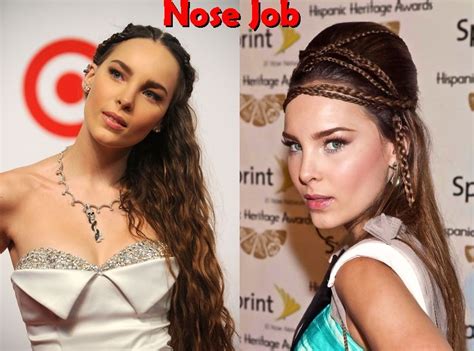 Belinda Peregrin Nose Job Plastic Surgery Before And After