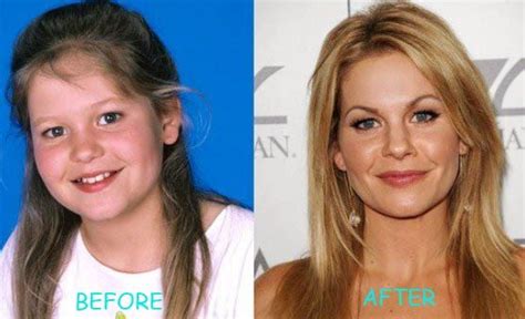 211 Best Images About Celebrity Before After On Pinterest